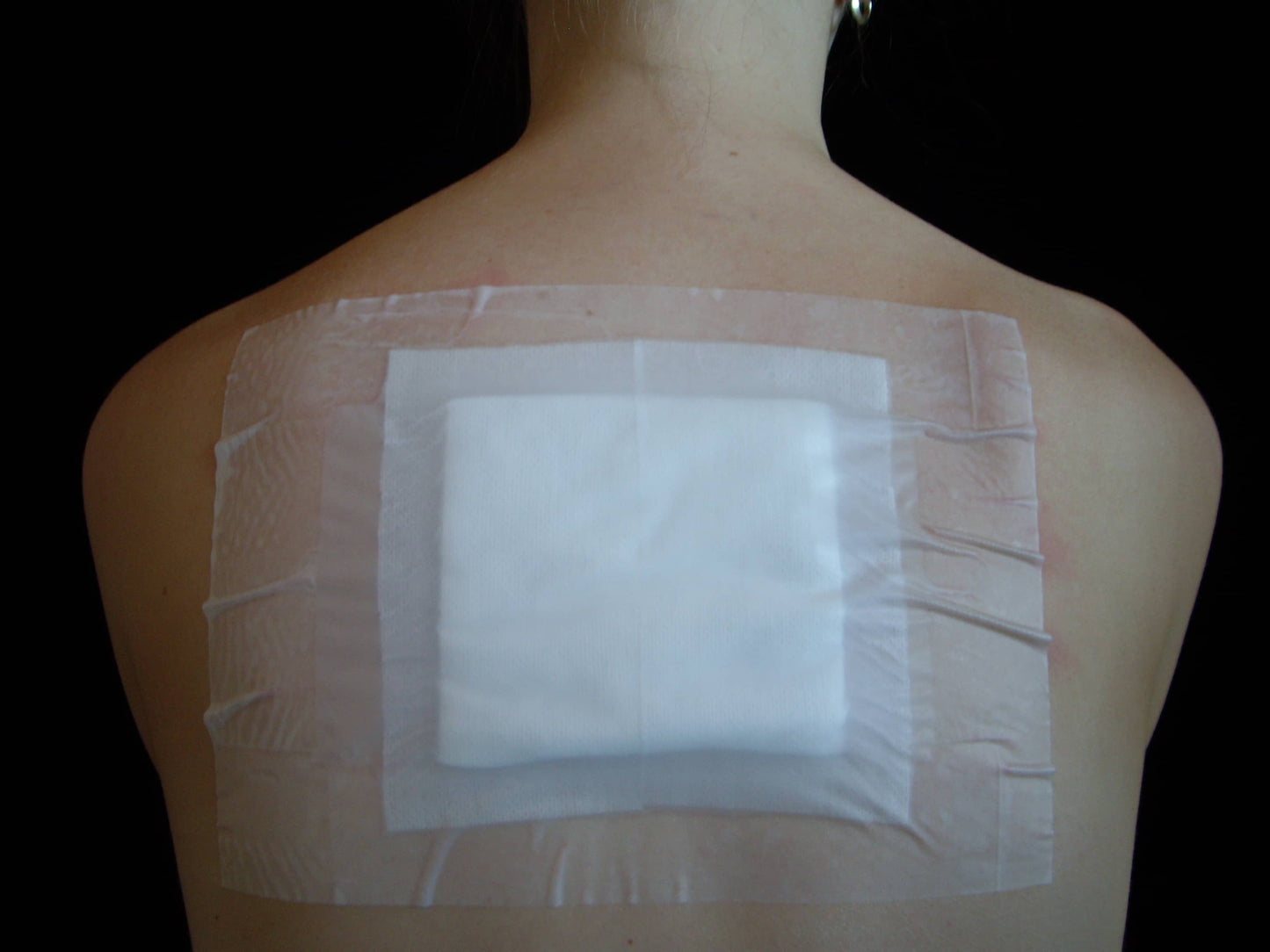 nursing innovations blue rectangle protector in use on patients back